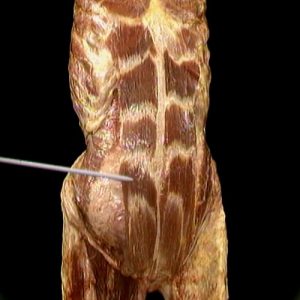 آناتومی بدن