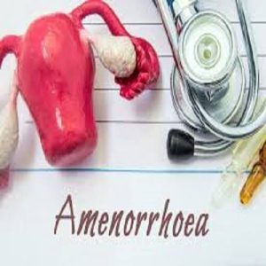 آمنوره ورزشی